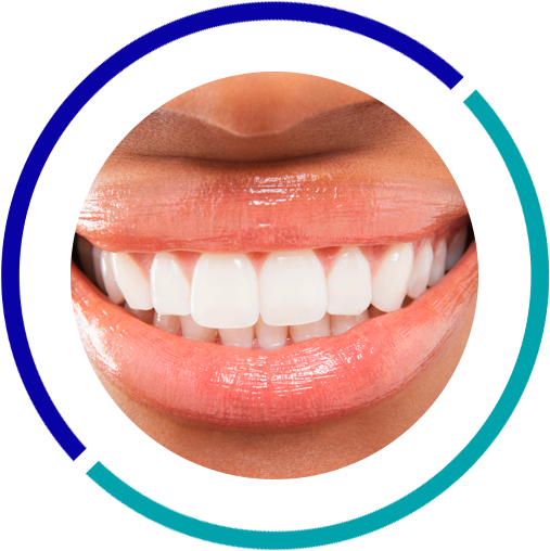 Cosmetic Dentistry - Black Woman White Teeth (507x508), Png Download