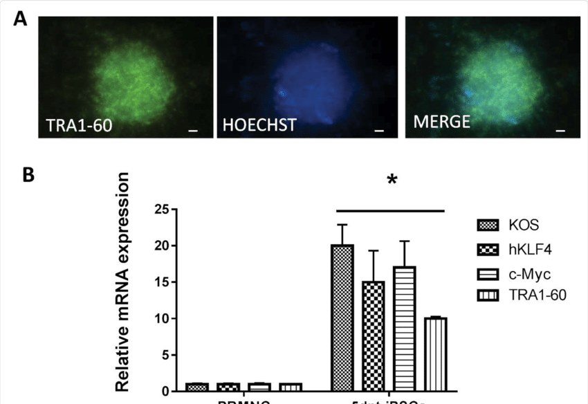 Reprogramming Example Of Peripheral Blood Mononucleated - Diagram (850x584), Png Download
