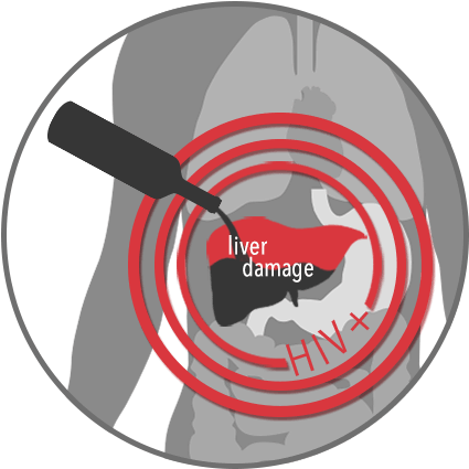 Alcohol Damages The Liver - Hiv/aids (475x450), Png Download