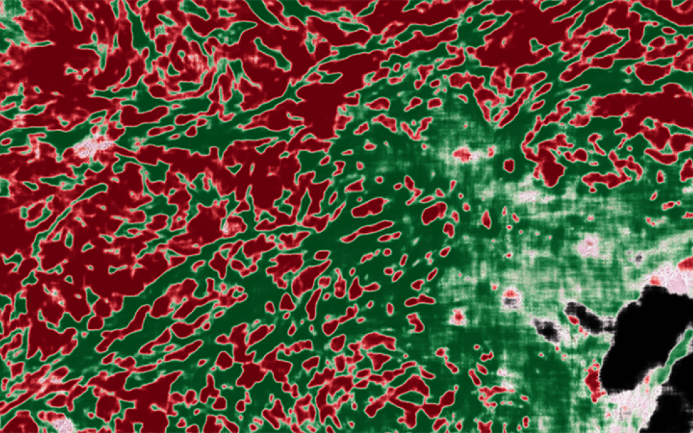 Ai Image Overlay Of Pathology Image - Artificial Intelligence (1000x625), Png Download