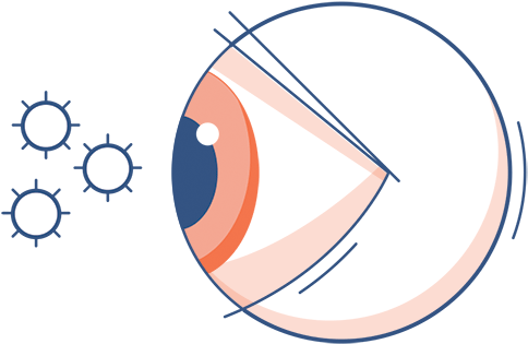 Eye Allergy Symptoms - Allergy (520x400), Png Download