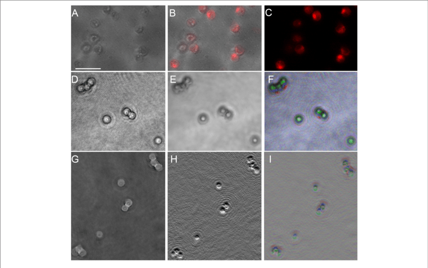 Picocystis Salinarum Under Light Microscopy And Dhm - Lensless Imaging Of E Coli (850x532), Png Download