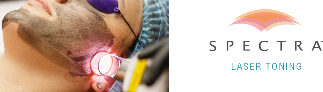 Spectra Laser Toning - Laser (1200x300), Png Download