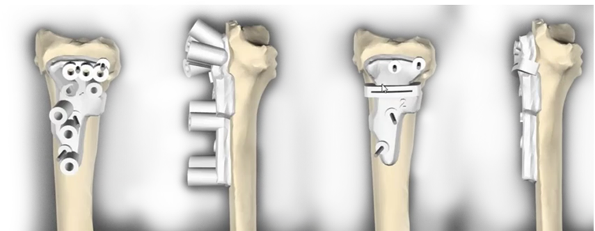 Verstreken Concludes By Listing Three Advantages That - Firearm (855x332), Png Download