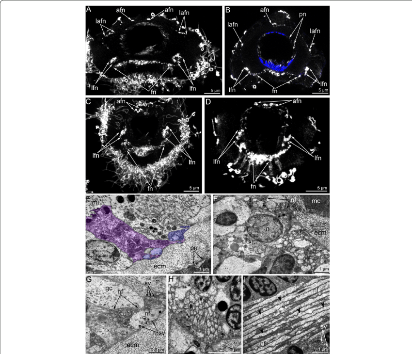 Innervation Of Tentacles Of Hemithiris Psittacea - Common Fig (850x730), Png Download
