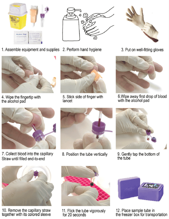 Illustration For Capillary Blood Sampling - Lilac (850x768), Png Download