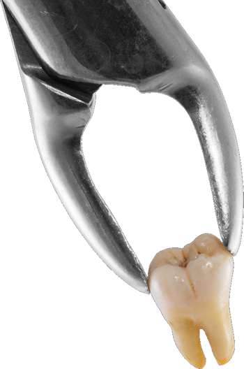 Tooth Extractions - Wayne, Nj - Dental Extraction (350x528), Png Download