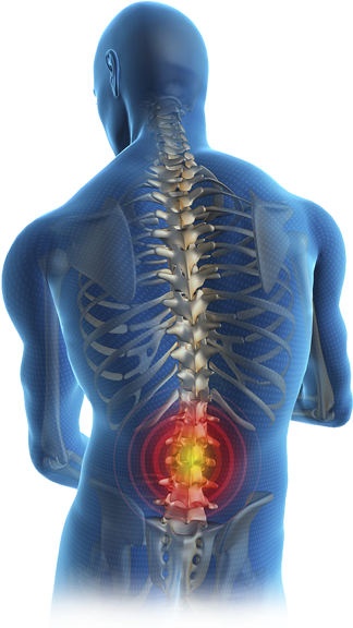 Lower Back Pain (329x585), Png Download