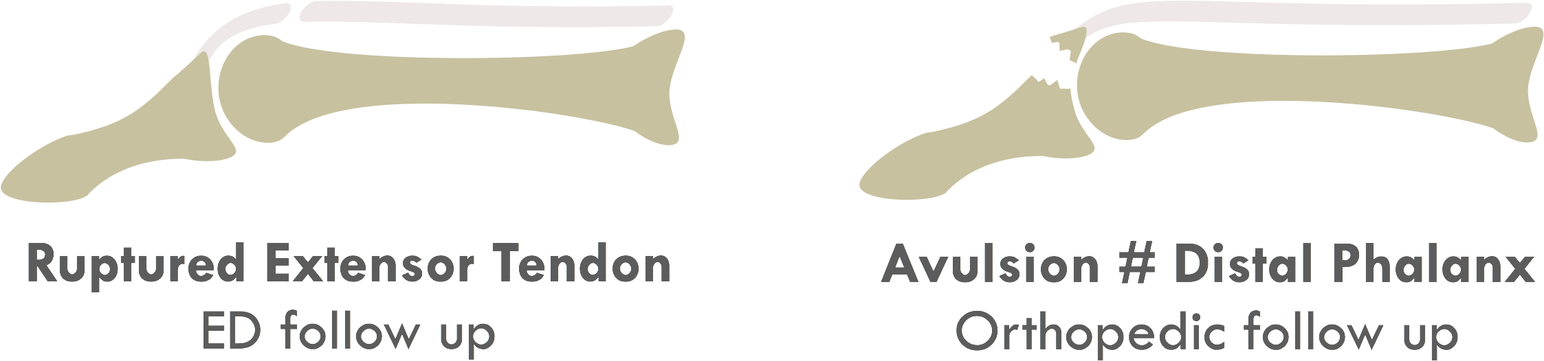 Tendon Injuries Tend To Show Less Swelling/tenderness (2500x525), Png Download