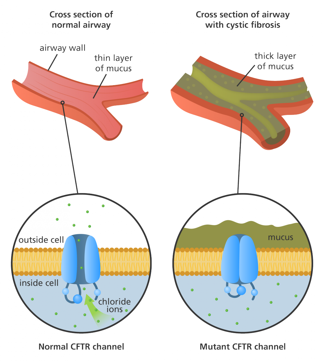 An Illustration To Show Normal And Mutant Cftr Channels, - Cftr Cystic Fibrosis (1075x1200), Png Download