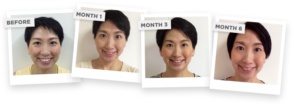 As I Was Approaching My 40's I Noticed My Face Started - Girl (1022x367), Png Download