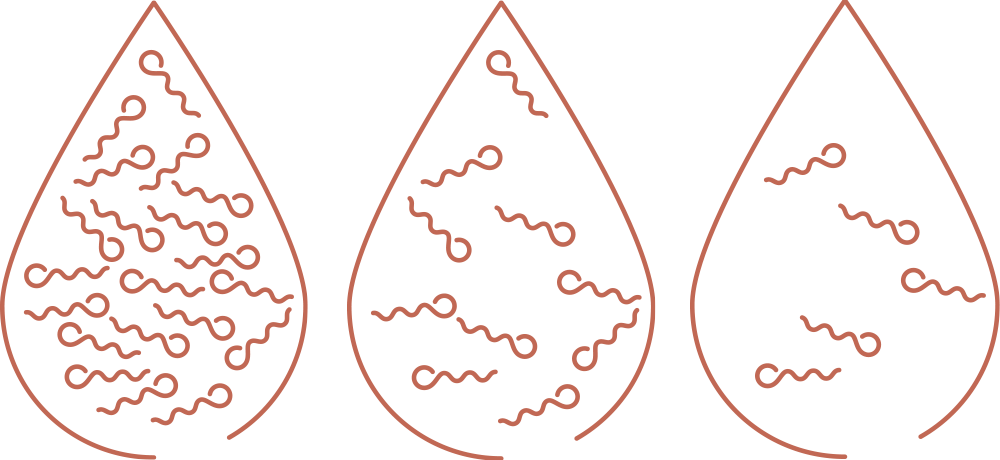 Sperm Count And Sperm Quality Motility - Diagram (1000x460), Png Download