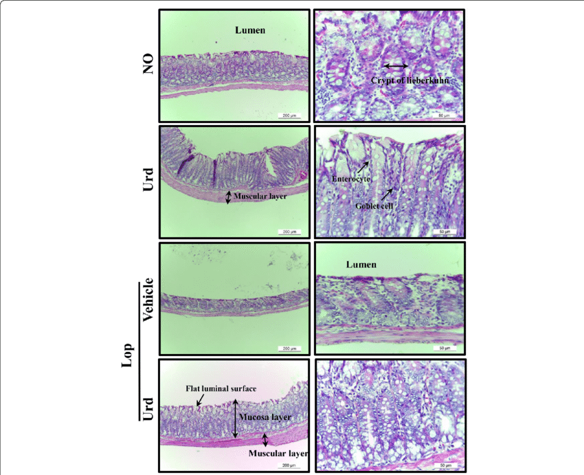 Alteration Of Histological Structures In Lop-induced - Fig.1 (850x691), Png Download