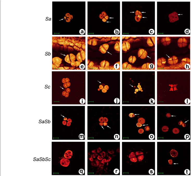 Pollen Abortion Stages Of Autotetraploid Rice Hybrids - Abortion (850x673), Png Download