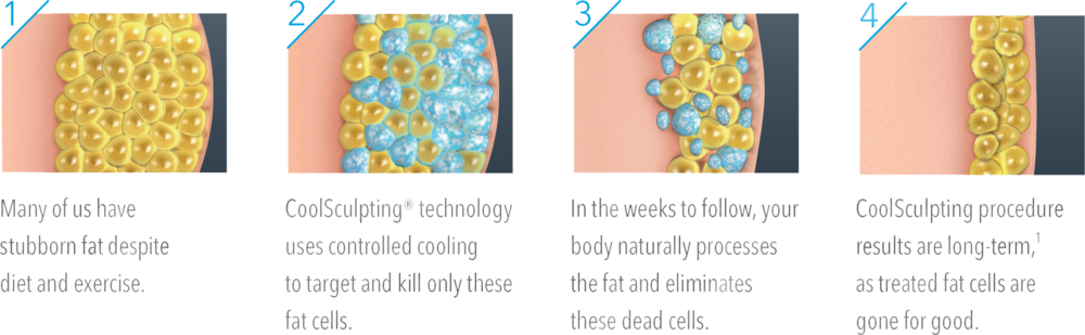 Infinity Medspa Wellness Coolsculpting - Cool Sculpting (1000x309), Png Download