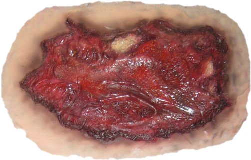 Realistic Scar Png - Wound Png (988x348), Png Download