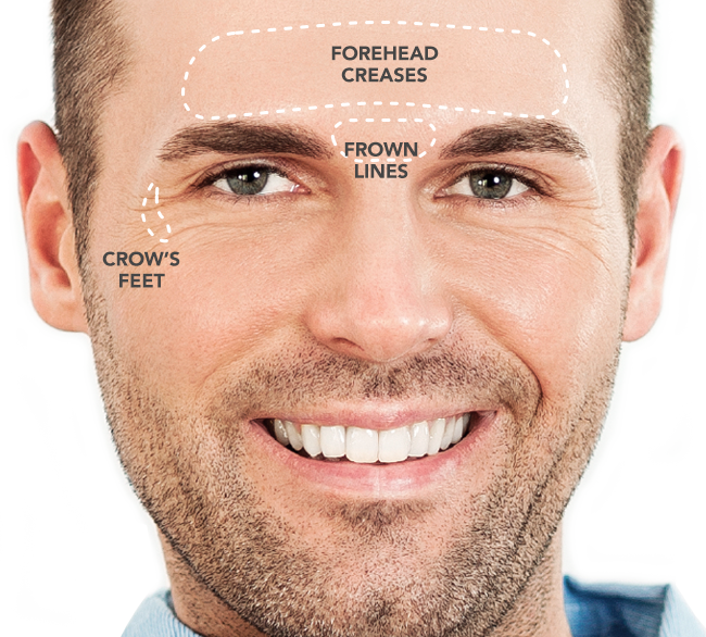 December Is Here Introduce Your Man To - Collagen In Face Men (650x586), Png Download