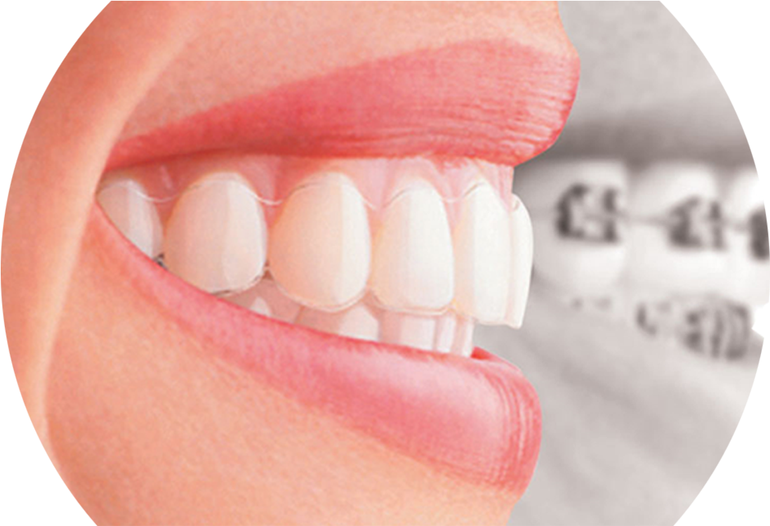 Improve Your Speech - Theory And Advanced Researches In Orthodontics (1192x958), Png Download