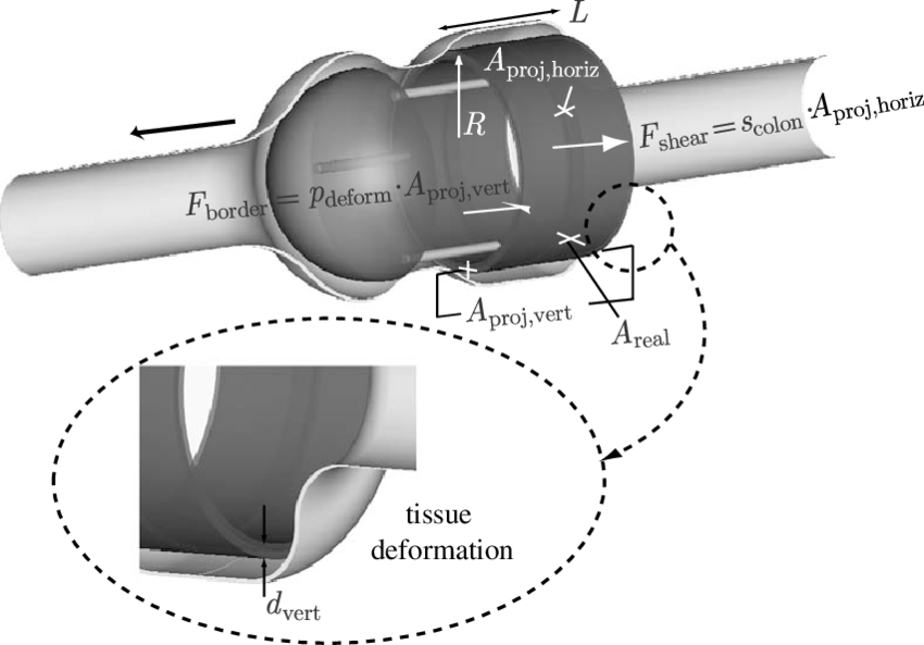 Colonic Tissue Wrapping In The Case Of Geometry - Diagram (850x593), Png Download
