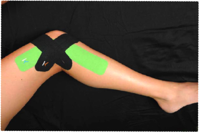 As Many Of You Already Know, Or May Have Realized Through - Kt Tape Knee It Band (989x787), Png Download