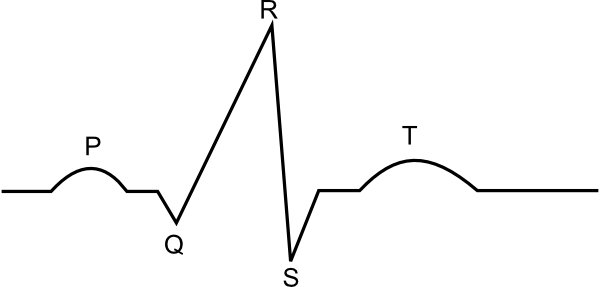 How To Set Use Ekg Diagram Svg Vector (600x287), Png Download