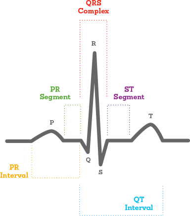 Also Known As An Electrocardiogram Or An Ekg, An Ecg - Diagram (384x435), Png Download