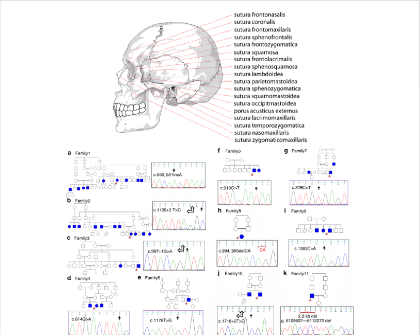 Schematic View Of Human Skull Sutures And Nucleotide - Human Skull Side View (850x678), Png Download