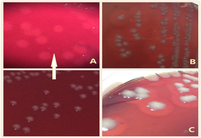 Haemolytica Colonies On B - Pasteurella (903x472), Png Download