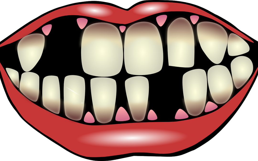 9 Factors For Losing Your Teeth - Bright Smile Clipart (1080x675), Png Download