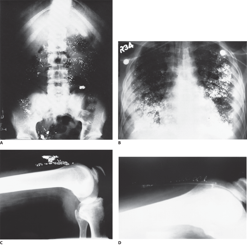 Image Not Available - Radiology (840x836), Png Download