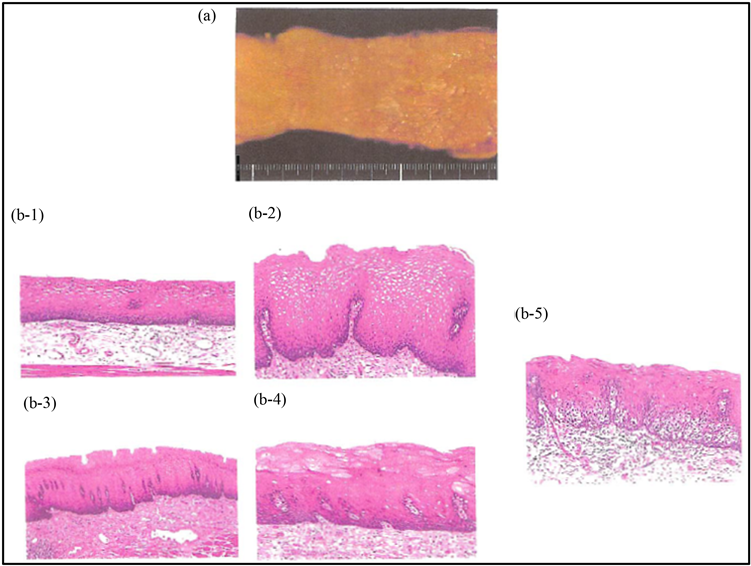 Macroscopic View And Histology (b) Of Human Esophageal - Pattern (903x569), Png Download