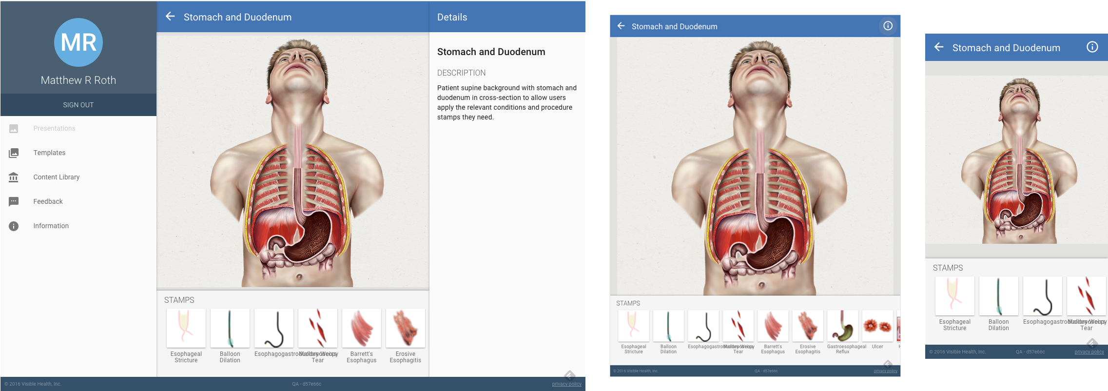 Works On Iphone, Ipad, Web And Android - Android (2322x801), Png Download