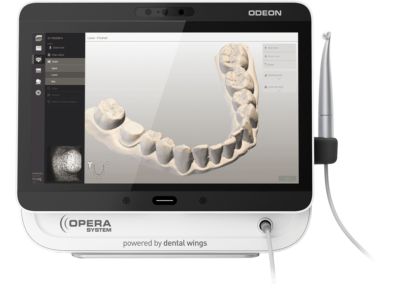 Dental Wings Portable Intraoral Scanner (1500x1062), Png Download