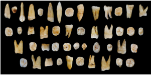 Can 100,000 Year Old Teeth Change Human History - Found A Tooth On The Beach (300x200), Png Download
