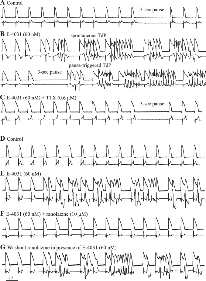 Representative Recordings Of The Anti Arrhythmic Effects - Handwriting (678x925), Png Download