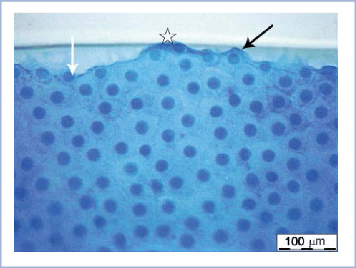 Anterior Lens Capsule Following Manual Capsulorhexis - Swimming Pool (702x530), Png Download