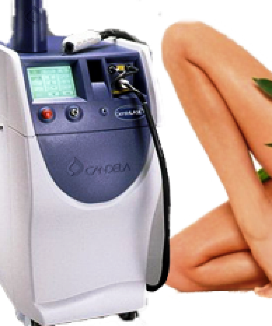 What Are The Features Of Candela Alexandrite Laser - Alexandrite Laser (881x1056), Png Download