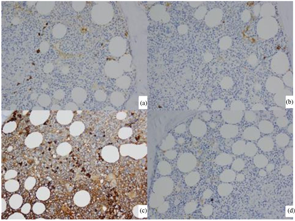 200×, Few Plasma Cells Positive For Kappa Light Chain - Tile (902x437), Png Download