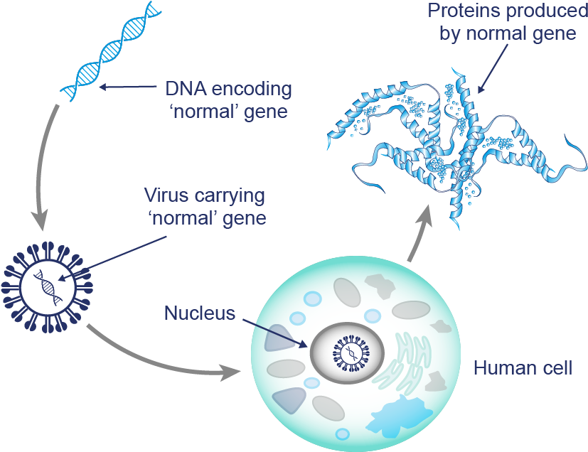 Despite The Viruses Being Specifically 'programmed' - Gene Therapy (1080x811), Png Download