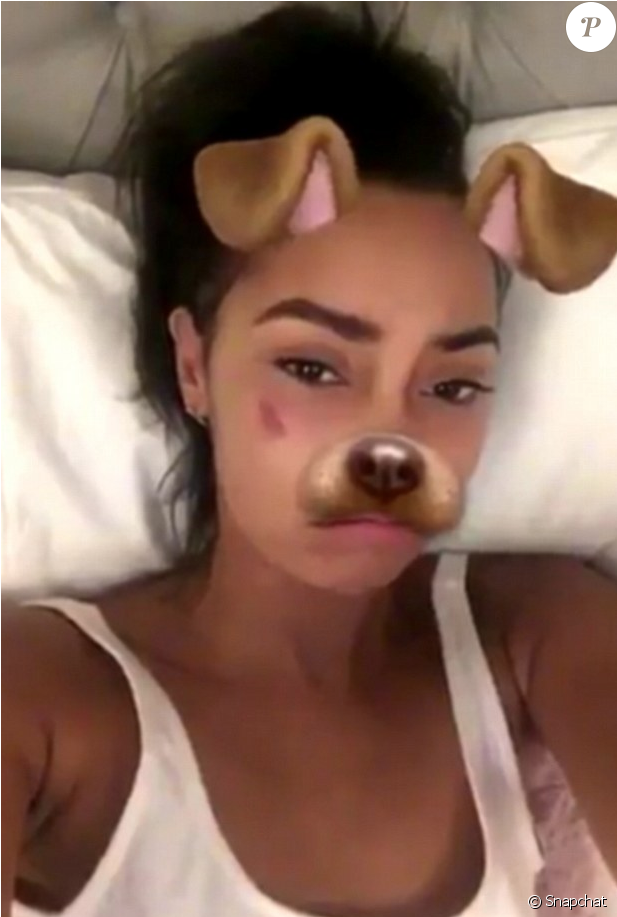 Leigh-anne Pinnock, La Chanteuse Des Little Mix A Publié - Tiny Bruise On Face (950x916), Png Download