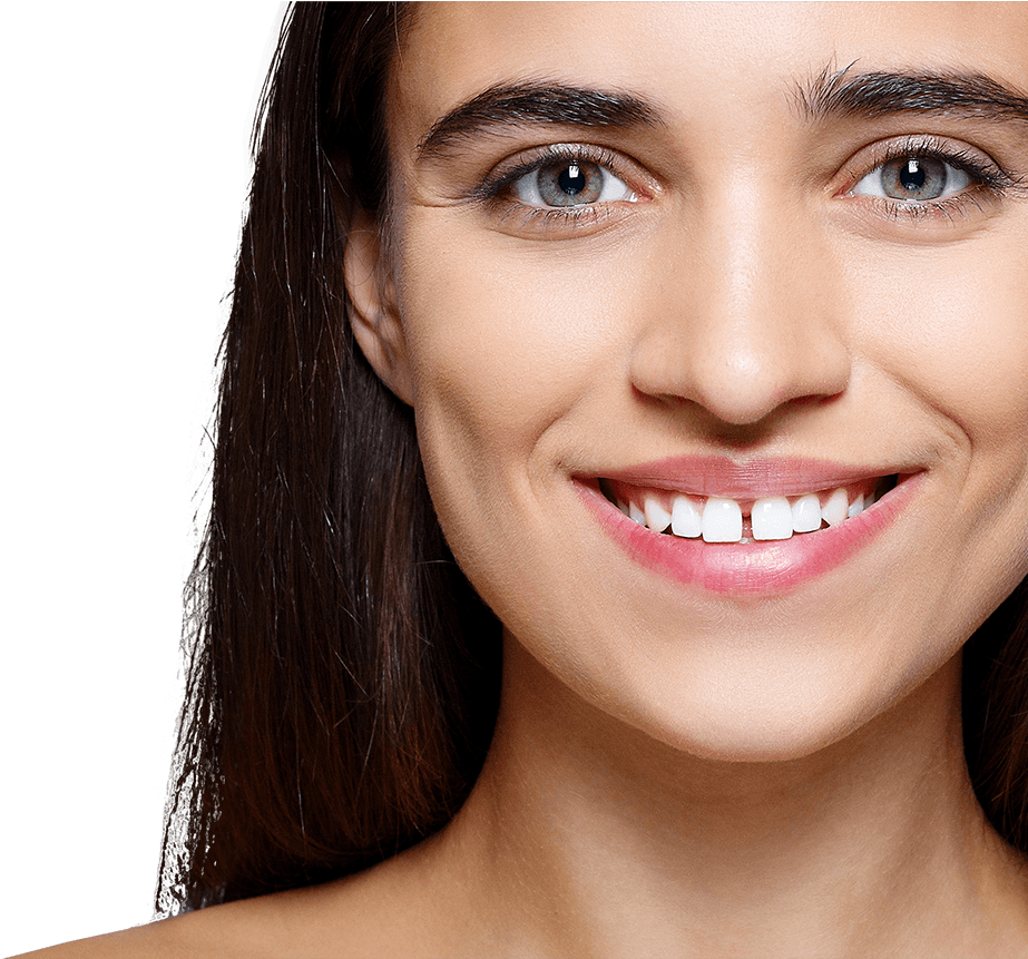Attractive Smiling Woman With Gap Between Her Front - Gap Smile (960x950), Png Download