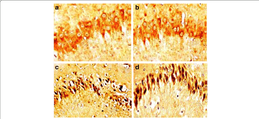 Effect Of Egcg On The Hippocampus After Fl Exposure - Common Fig (850x392), Png Download