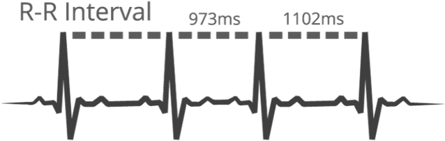 Between Each Heartbeat - Overtraining (666x220), Png Download