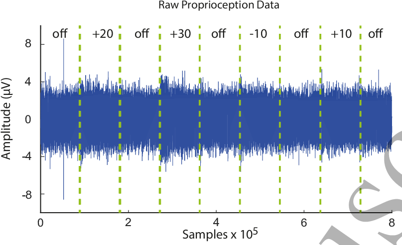 Filtered Nerve Signal Recorded From One Electrode On (814x505), Png Download