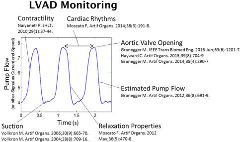 Hemodynamic Parameters Analyzed Using Ready Available - Ventricular Assist Device (500x300), Png Download