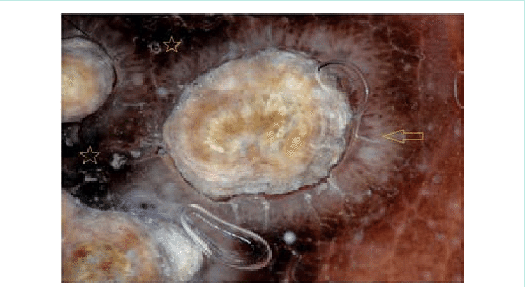 Close Up View Showing Demonstrates Yellowish-white - Yellow (744x407), Png Download