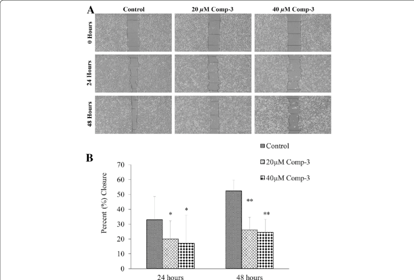 A Anti Migration Potential Of Compound 3 At 20 And - Cell (850x576), Png Download