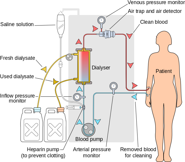 Hemodialysis Acts As An Artificial Kidney To Filter - Artificial Kidney Dialysis (654x564), Png Download