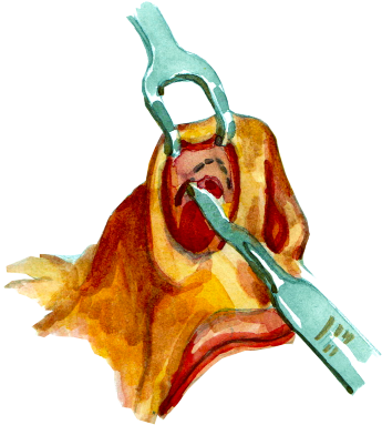 Viksraitis, Viksraitis - Sv Plastinės Chirurgijos Centras (480x513), Png Download