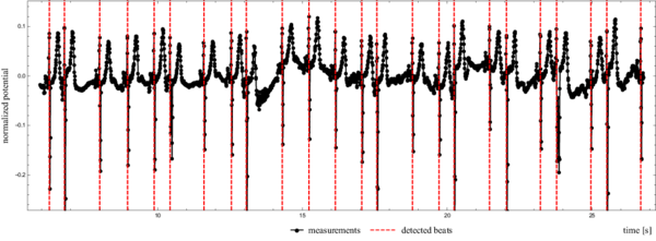 Actual Heartbeat Detected Beat To Beat - Pulse (600x221), Png Download